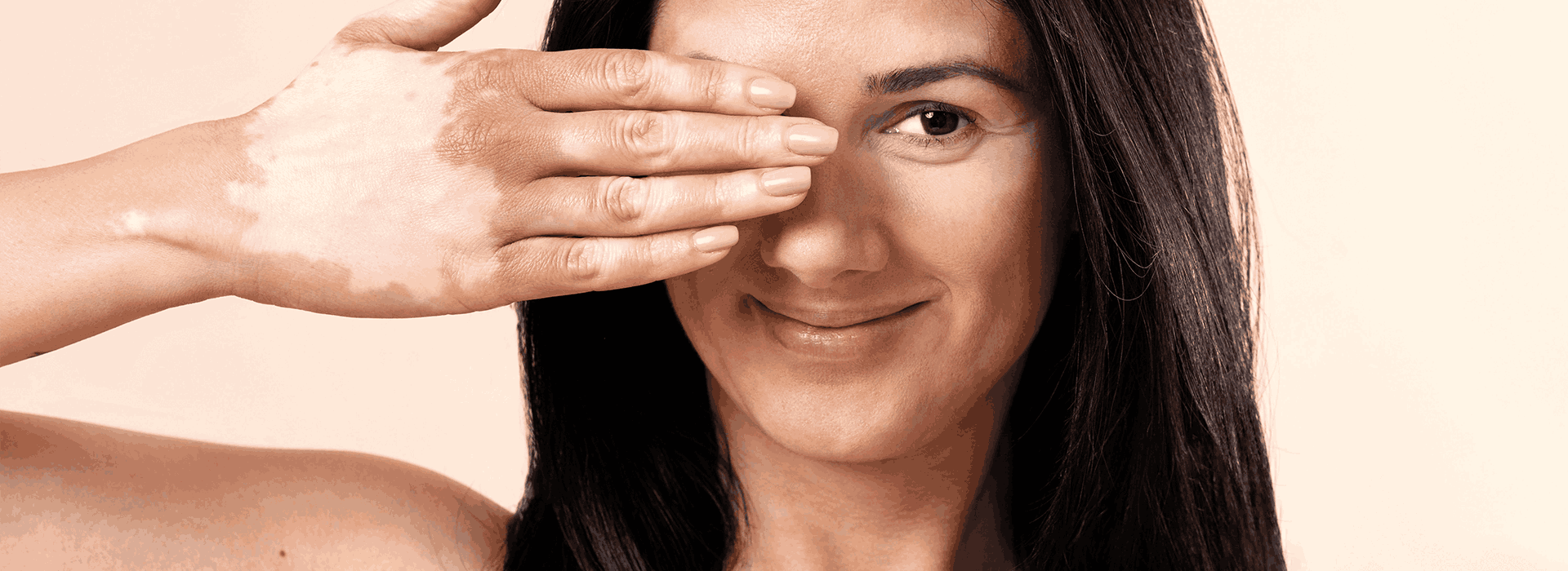 Почему возникает пигментация кожи и как с этим бороться